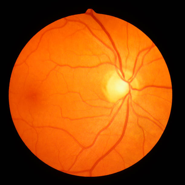 Retina